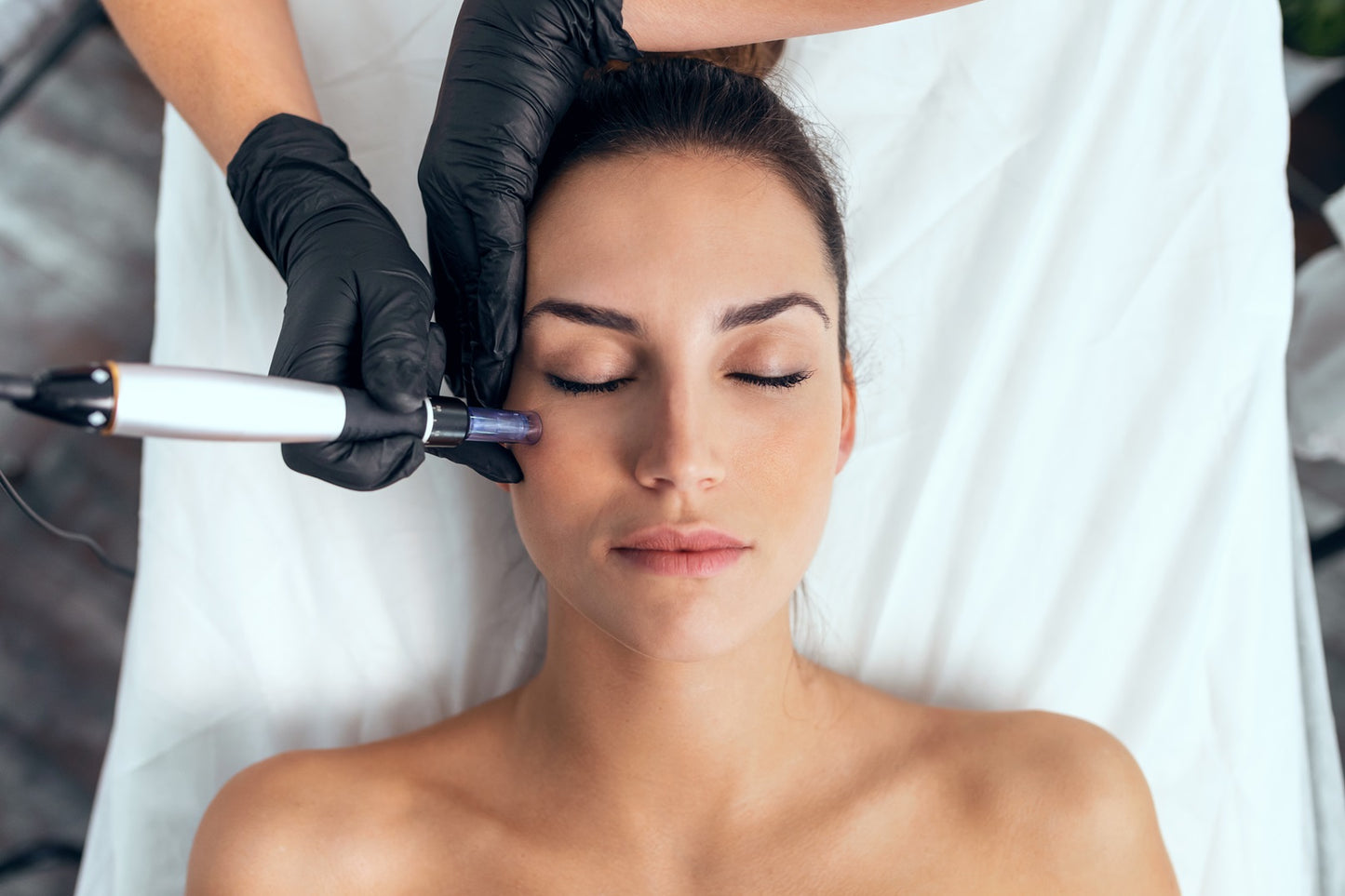 Microneedling Facial with Custom Serums for Skin Rejuvenation